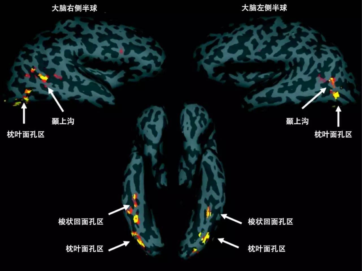 大脑中和面孔识别有关的区域